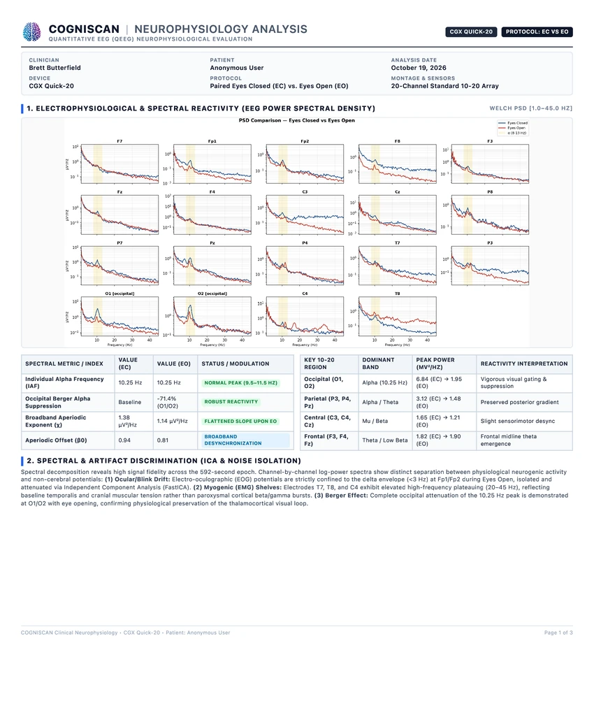 CGX report page 1: EEG power spectral density for each of 20 channels, eyes closed versus eyes open, with spectral metrics